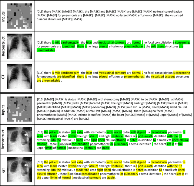 Figure 4 for Multi-task Paired Masking with Alignment Modeling for Medical Vision-Language Pre-training