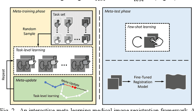Figure 3 for Meta-Learning Initializations for Interactive Medical Image Registration
