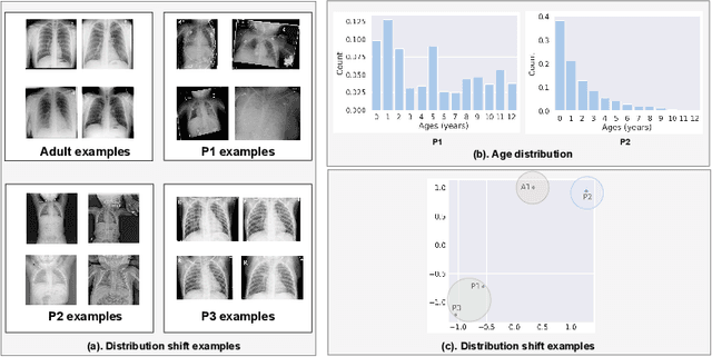 Figure 1 for Self-Supervised Learning for Building Robust Pediatric Chest X-ray Classification Models