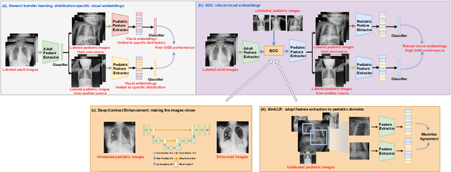 Figure 2 for Self-Supervised Learning for Building Robust Pediatric Chest X-ray Classification Models