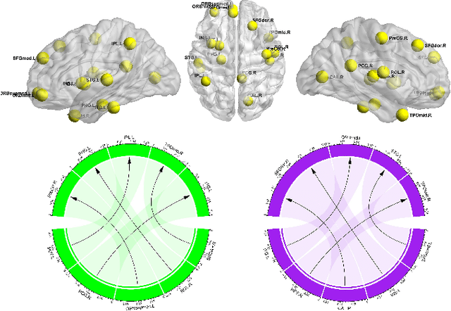 Figure 2 for Brain Diffuser with Hierarchical Transformer for MCI Causality Analysis