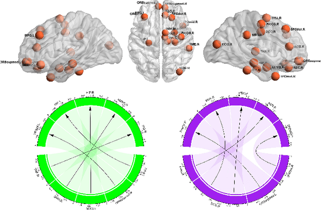 Figure 3 for Brain Diffuser with Hierarchical Transformer for MCI Causality Analysis