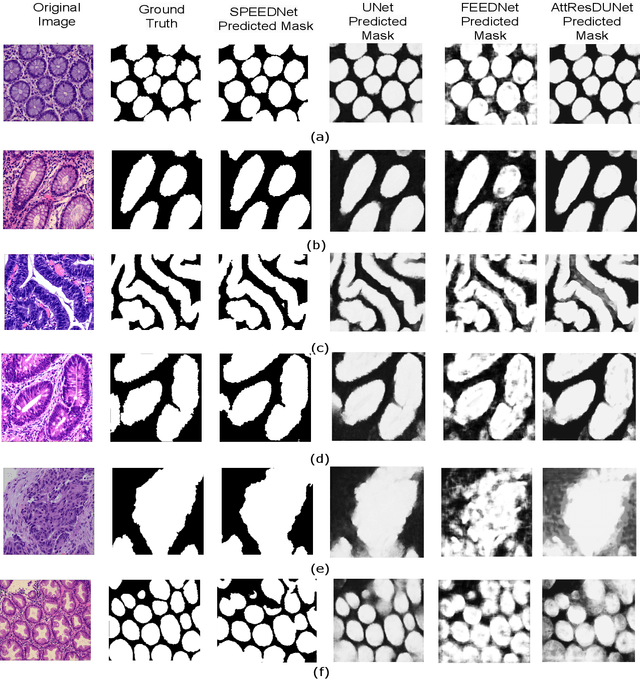 Figure 3 for SPEEDNet: Salient Pyramidal Enhancement Encoder-Decoder Network for Colonoscopy Images