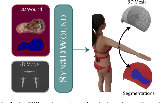 Figure 1 for Syn3DWound: A Synthetic Dataset for 3D Wound Bed Analysis