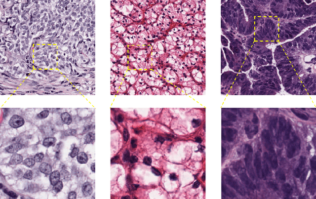 Figure 1 for Learning to Generalize over Subpartitions for Heterogeneity-aware Domain Adaptive Nuclei Segmentation