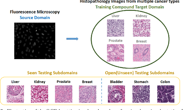 Figure 3 for Learning to Generalize over Subpartitions for Heterogeneity-aware Domain Adaptive Nuclei Segmentation