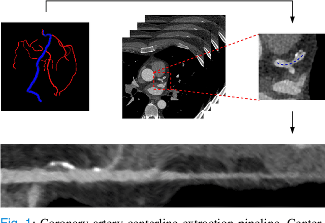 Figure 1 for Automatic Coronary Artery Plaque Quantification and CAD-RADS Prediction using Mesh Priors