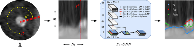 Figure 3 for Automatic Coronary Artery Plaque Quantification and CAD-RADS Prediction using Mesh Priors