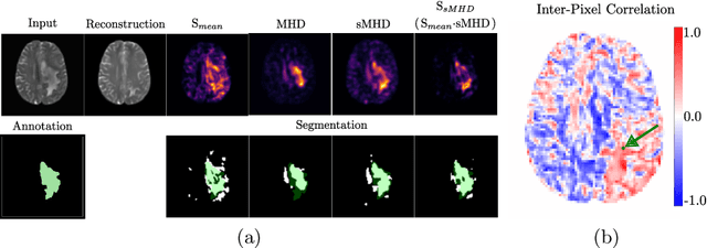 Figure 2 for Leveraging the Mahalanobis Distance to enhance Unsupervised Brain MRI Anomaly Detection