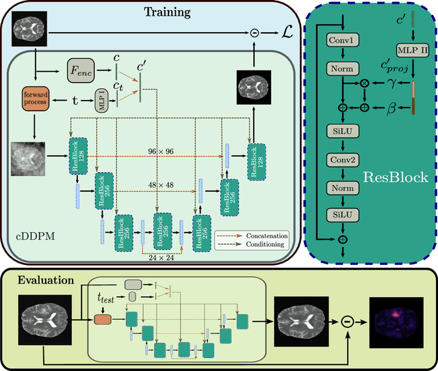 Figure 1 for Guided Reconstruction with Conditioned Diffusion Models for Unsupervised Anomaly Detection in Brain MRIs