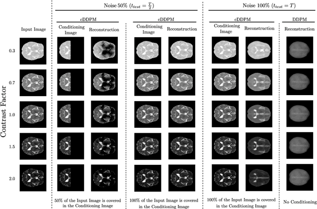 Figure 4 for Guided Reconstruction with Conditioned Diffusion Models for Unsupervised Anomaly Detection in Brain MRIs