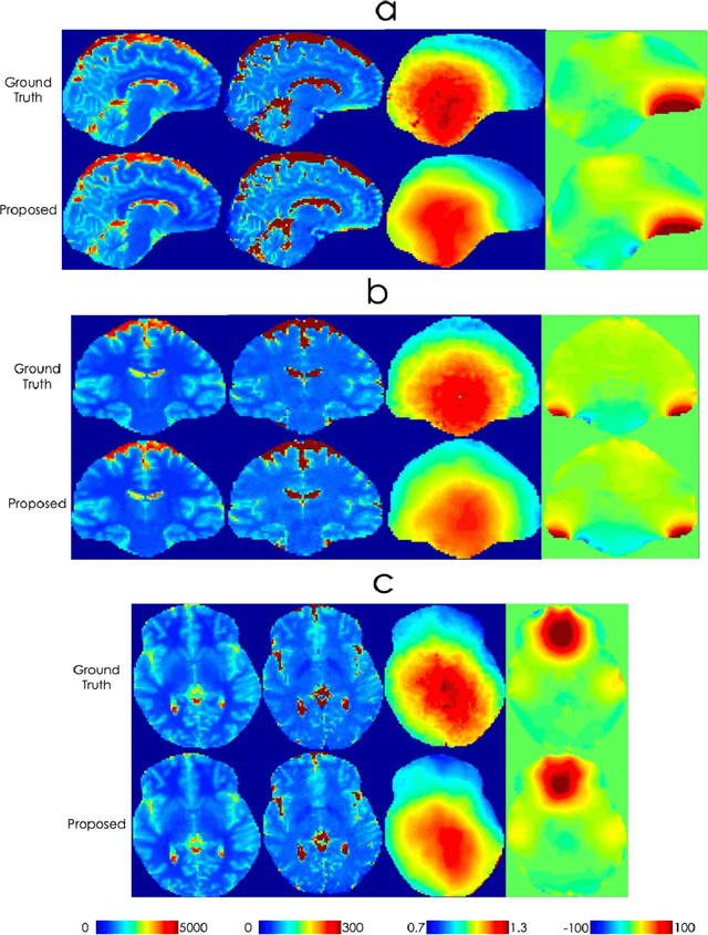 Figure 3 for Sequence adaptive field-imperfection estimation (SAFE): retrospective estimation and correction of $B_1^+$ and $B_0$ inhomogeneities for enhanced MRF quantification