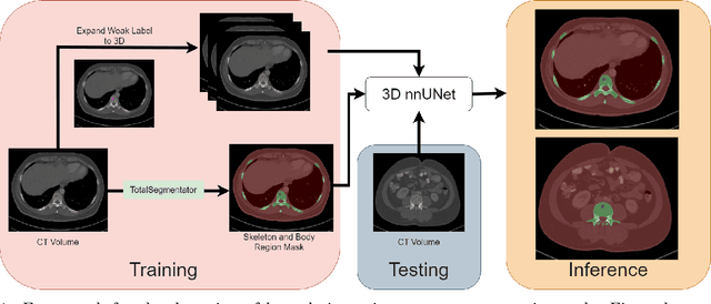 Figure 1 for Weakly-Supervised Detection of Bone Lesions in CT