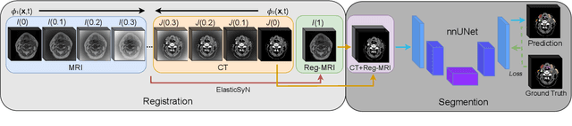 Figure 1 for SegReg: Segmenting OARs by Registering MR Images and CT Annotations