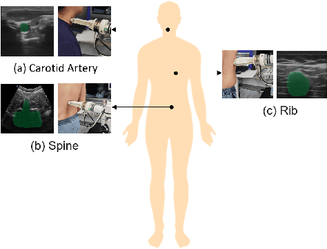 Figure 4 for Transforming Surgical Interventions with Embodied Intelligence for Ultrasound Robotics