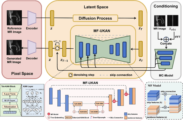 Figure 1 for TC-KANRecon: High-Quality and Accelerated MRI Reconstruction via Adaptive KAN Mechanisms and Intelligent Feature Scaling