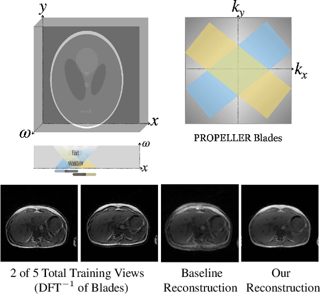 Figure 1 for Volumetric Reconstruction Resolves Off-Resonance Artifacts in Static and Dynamic PROPELLER MRI