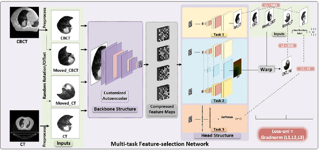 Figure 3 for Feature-oriented Deep Learning Framework for Pulmonary Cone-beam CT (CBCT) Enhancement with Multi-task Customized Perceptual Loss