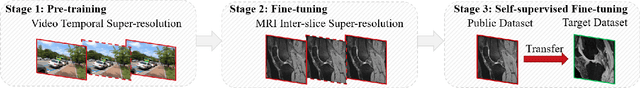 Figure 1 for Inter-slice Super-resolution of Magnetic Resonance Images by Pre-training and Self-supervised Fine-tuning