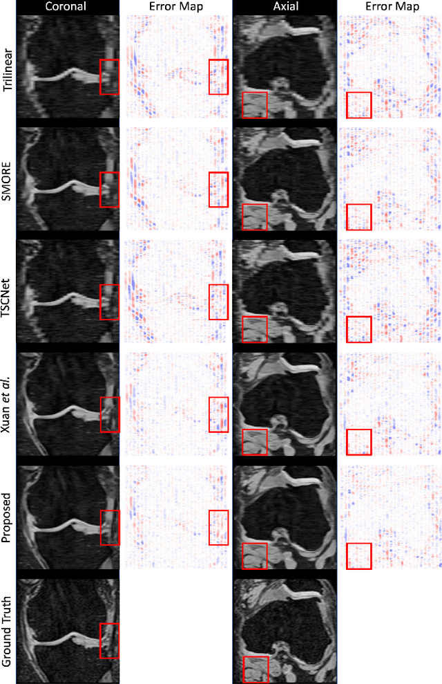 Figure 4 for Inter-slice Super-resolution of Magnetic Resonance Images by Pre-training and Self-supervised Fine-tuning