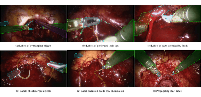 Figure 3 for SAR-RARP50: Segmentation of surgical instrumentation and Action Recognition on Robot-Assisted Radical Prostatectomy Challenge