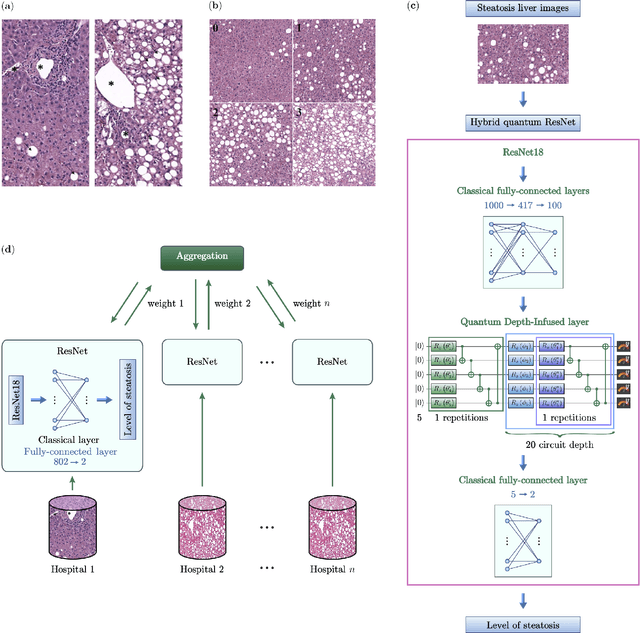 Figure 1 for Hybrid quantum image classification and federated learning for hepatic steatosis diagnosis