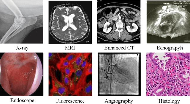 Figure 1 for Qilin-Med-VL: Towards Chinese Large Vision-Language Model for General Healthcare