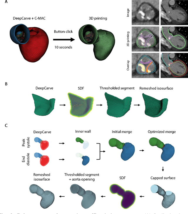 Figure 4 for AI-powered multimodal modeling of personalized hemodynamics in aortic stenosis