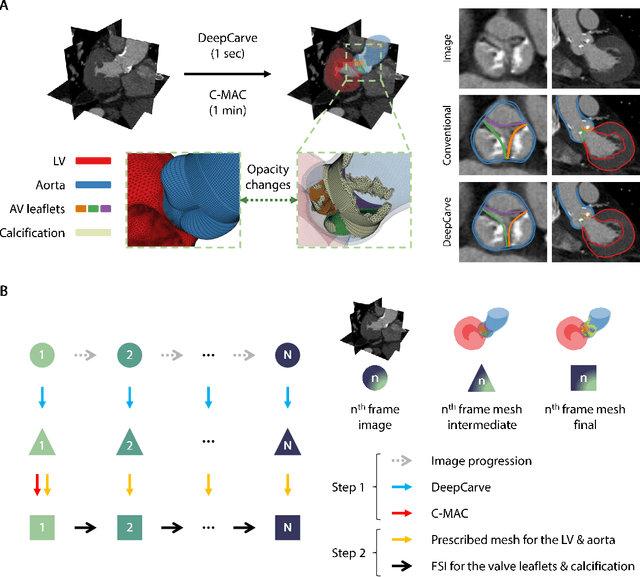 Figure 3 for AI-powered multimodal modeling of personalized hemodynamics in aortic stenosis