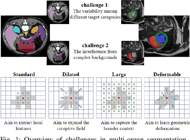 Figure 1 for SACNet: A Spatially Adaptive Convolution Network for 2D Multi-organ Medical Segmentation