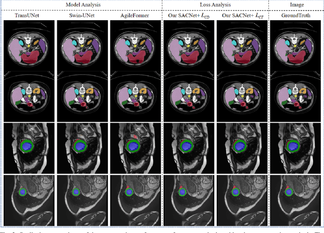 Figure 3 for SACNet: A Spatially Adaptive Convolution Network for 2D Multi-organ Medical Segmentation