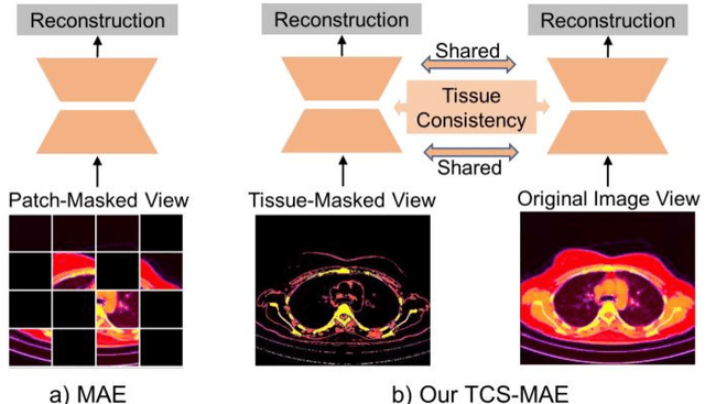 Figure 1 for Tissue-Contrastive Semi-Masked Autoencoders for Segmentation Pretraining on Chest CT