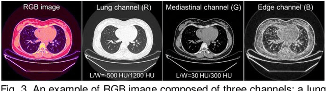 Figure 3 for Tissue-Contrastive Semi-Masked Autoencoders for Segmentation Pretraining on Chest CT