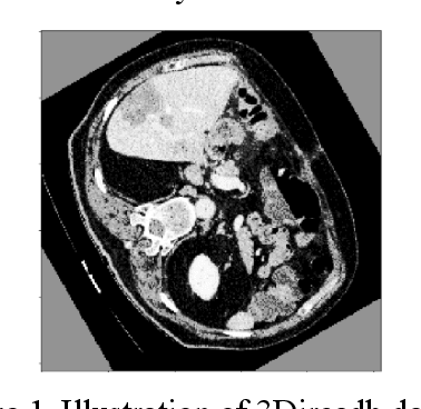 Figure 1 for Research on Tumors Segmentation based on Image Enhancement Method