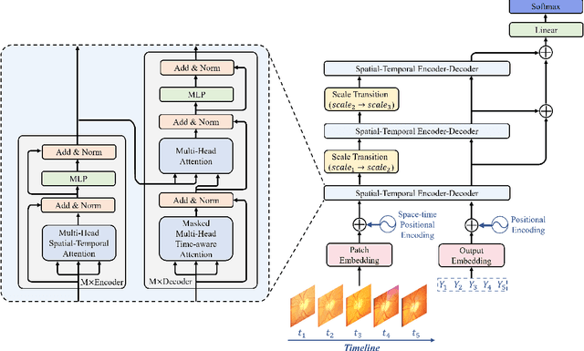 Figure 3 for Multi-scale Spatio-temporal Transformer-based Imbalanced Longitudinal Learning for Glaucoma Forecasting from Irregular Time Series Images