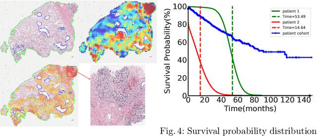 Figure 4 for SCMIL: Sparse Context-aware Multiple Instance Learning for Predicting Cancer Survival Probability Distribution in Whole Slide Images