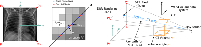 Figure 1 for Shadow and Light: Digitally Reconstructed Radiographs for Disease Classification