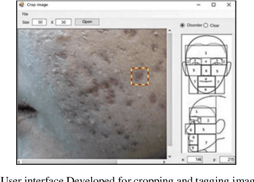 Figure 1 for Convolutional Neural Networks Towards Facial Skin Lesions Detection