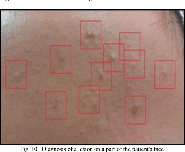 Figure 2 for Convolutional Neural Networks Towards Facial Skin Lesions Detection