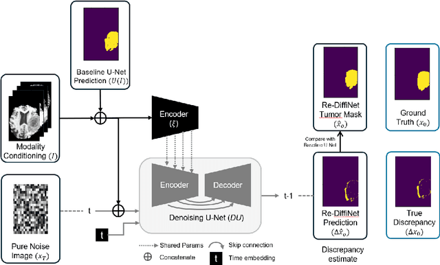 Figure 1 for Re-DiffiNet: Modeling discrepancies loss in tumor segmentation using diffusion models