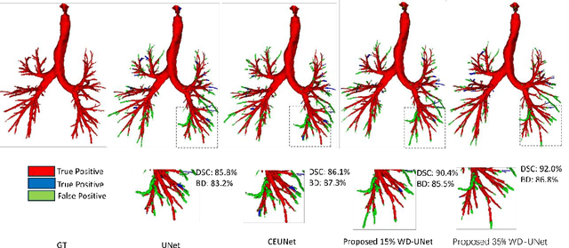 Figure 2 for Probing Perfection: The Relentless Art of Meddling for Pulmonary Airway Segmentation from HRCT via a Human-AI Collaboration Based Active Learning Method