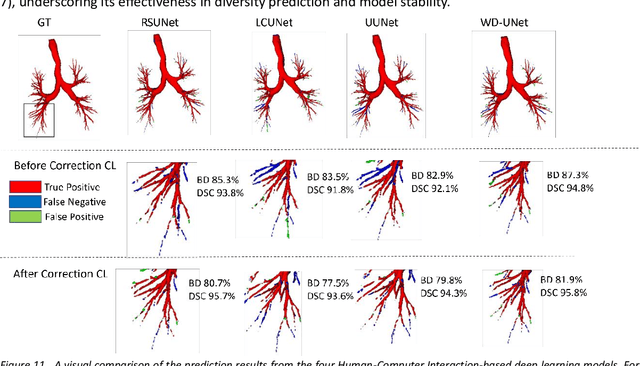 Figure 3 for Probing Perfection: The Relentless Art of Meddling for Pulmonary Airway Segmentation from HRCT via a Human-AI Collaboration Based Active Learning Method