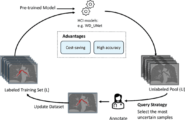 Figure 4 for Probing Perfection: The Relentless Art of Meddling for Pulmonary Airway Segmentation from HRCT via a Human-AI Collaboration Based Active Learning Method