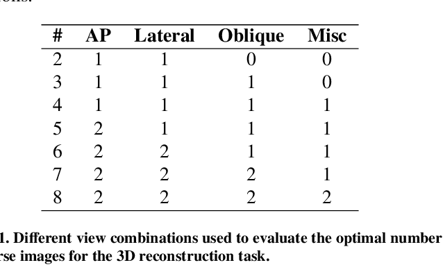 Figure 2 for Domain adaptation strategies for 3D reconstruction of the lumbar spine using real fluoroscopy data