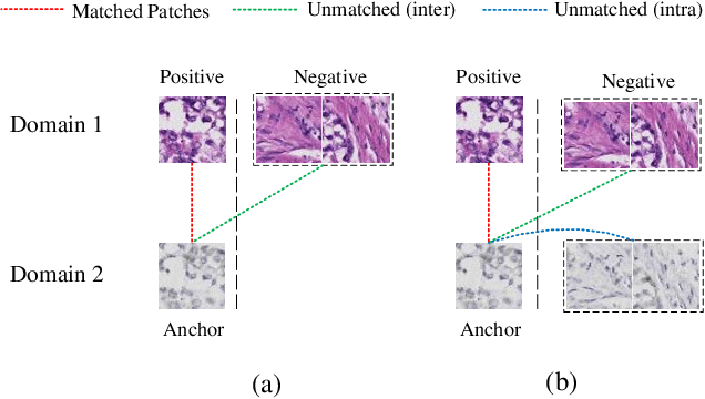 Figure 3 for Mix-Domain Contrastive Learning for Unpaired H&E-to-IHC Stain Translation