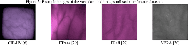 Figure 3 for Advanced Image Quality Assessment for Hand- and Fingervein Biometrics