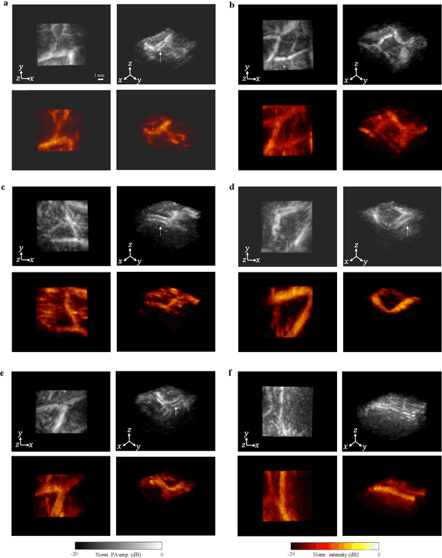 Figure 4 for Functional photoacoustic noninvasive Doppler angiography in humans