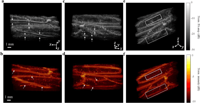 Figure 3 for Functional photoacoustic noninvasive Doppler angiography in humans