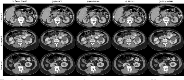 Figure 3 for ResNCT: A Deep Learning Model for the Synthesis of Nephrographic Phase Images in CT Urography