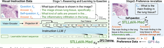 Figure 3 for STLLaVA-Med: Self-Training Large Language and Vision Assistant for Medical